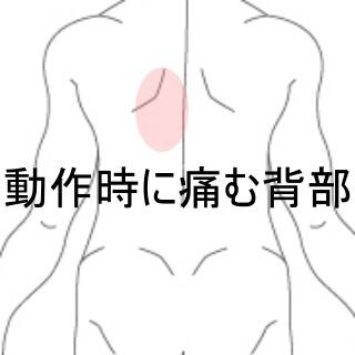 背部痛