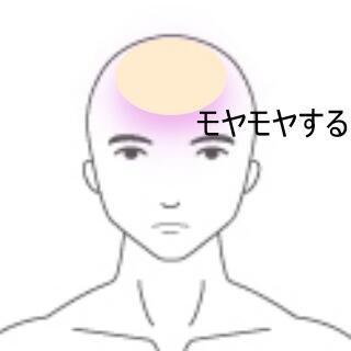 頭痛