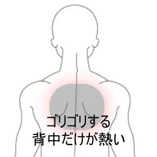 背部