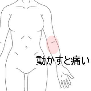 肘の痛み