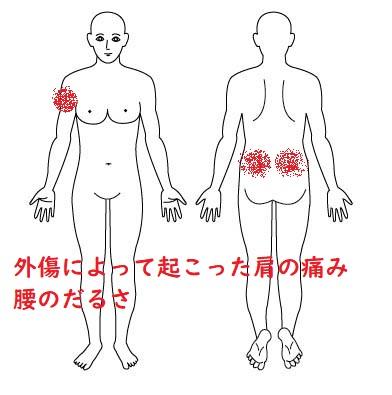 人体図 - コピー - コピー
