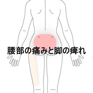 腰痛脚の痛み