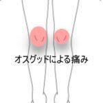 オスグッド