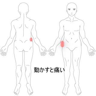 腰の痛み