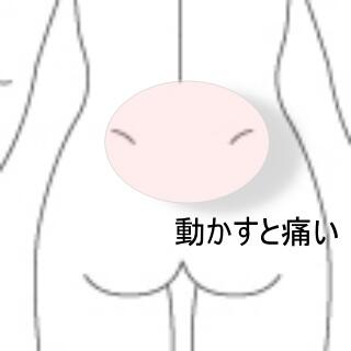腰臀部痛