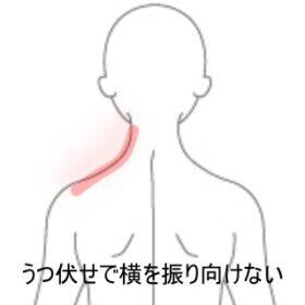 寝違え