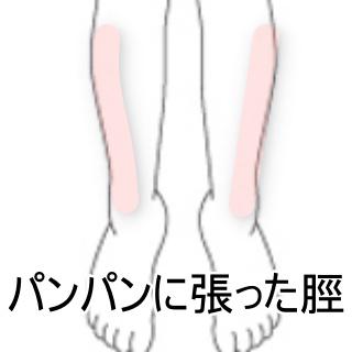 脛の痛み