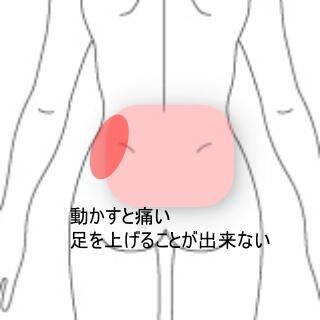 腰痛
