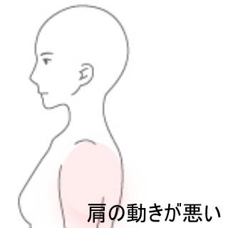 肩の痛み