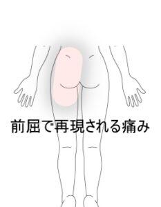 前屈動作で痛む腰