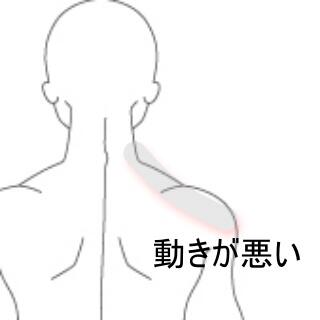 肩こり