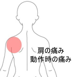 肩の痛み