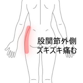 股関節側面の痛み