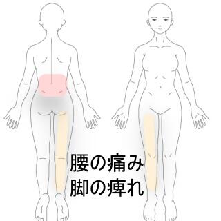 腰痛と足の痺れ