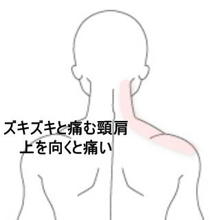 首の痛み