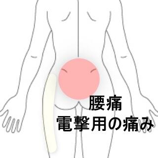 腰臀部痛