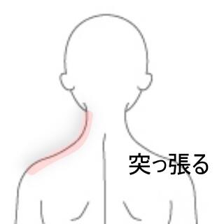 頸部痛