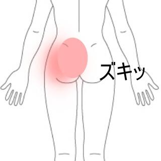 ぎっくり腰