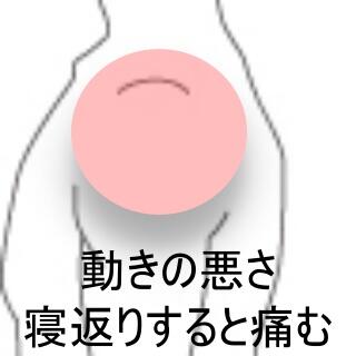 五十肩