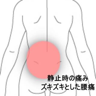 腰痛