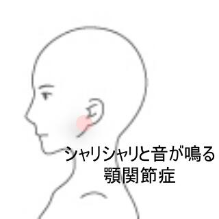 顎