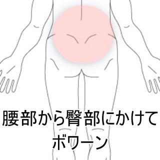 腰臀部痛