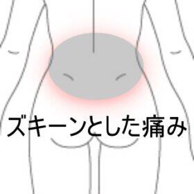 産後腰痛