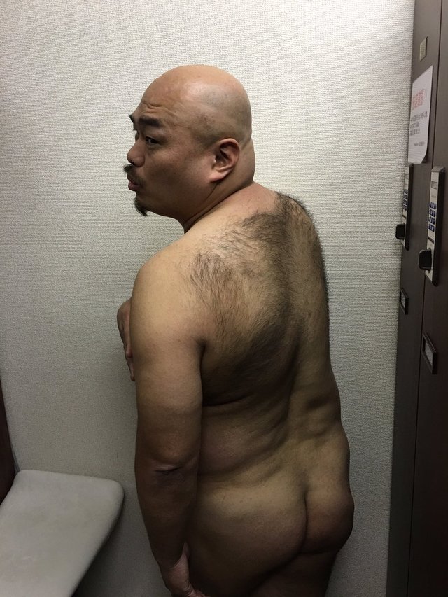 悲報 安田大サーカスクロちゃん ガチで入院ｗｗｗｗｗ スキャンダルニュース