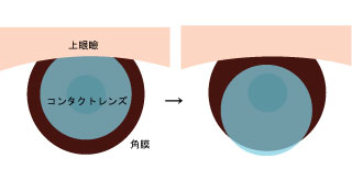 コンタクトレンズ Dvice News ｎｏ ８０ コンタクトレンズ アドバイス ブログ