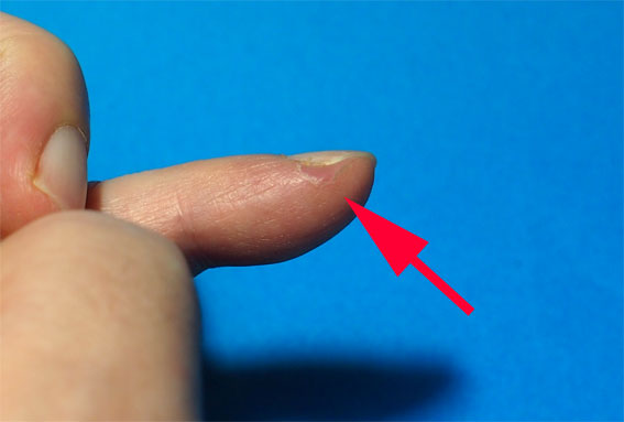 指先のささくれ さかむけの対策方法には 積極的に角質化した皮膚 タコ を切り取ることと保湿が大切だ 特に 鼻の脂を塗りつけておくのがオススメだ Sunday Gamerのブログ