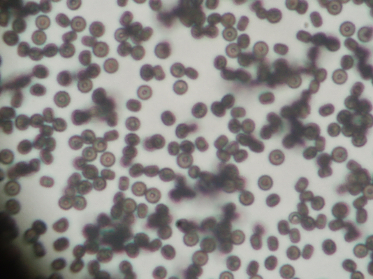 本日のカビ Sunny Style