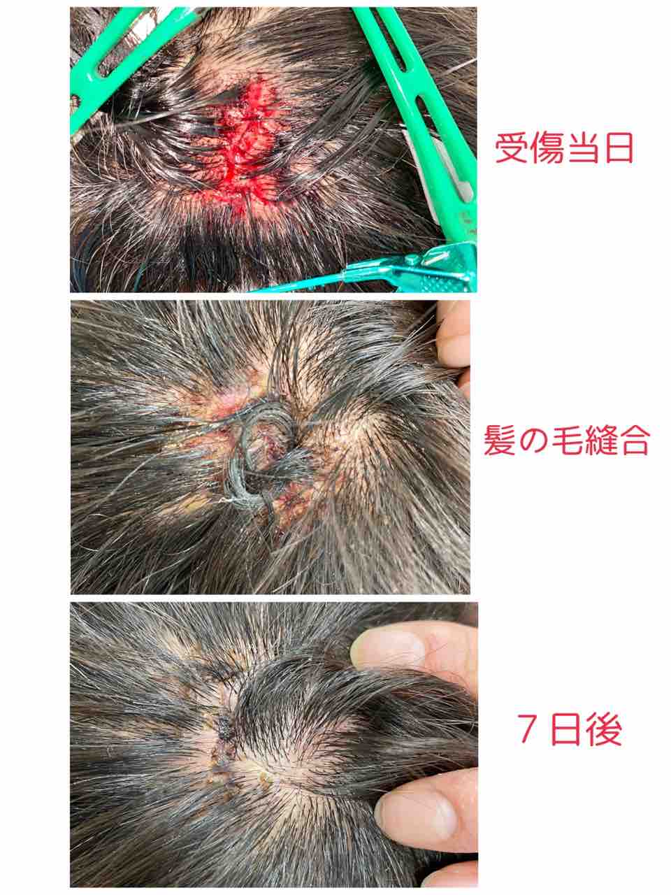 頭部をケガしてしまったら 頭のケガはなおりやすい 墨俣医院 公式ブログ