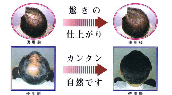 スーパーミリオンヘアーよりもフルヘアーがお勧めって スーパーミリオンヘアー 最安値 は ミリオンヘアーの副作用と口コミ