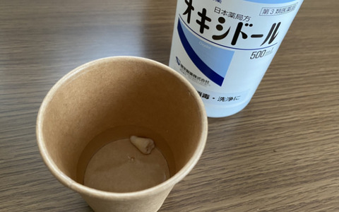 歯をアクセにした2