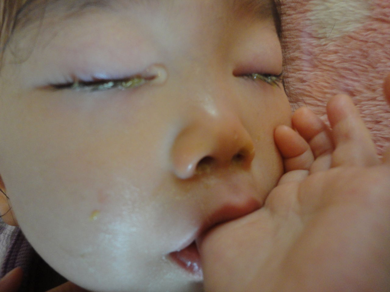 目やに 3姉妹とぐ たらmamasan