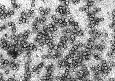 xvirology1_jpg_pagespeed_ic_8IXAfPkzap