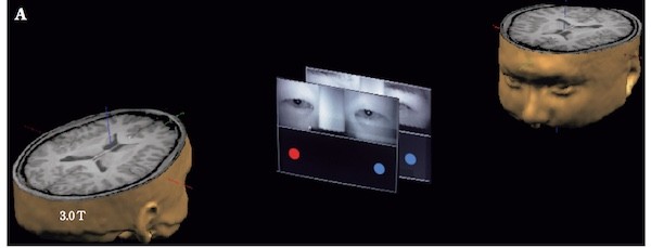 2個人同時計測MRI研究