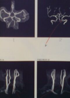 Ǿ�ɥå��θ�����̤ˤɤ��ɤ�