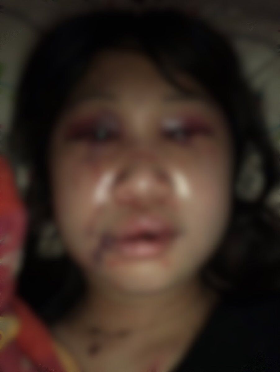 閲覧注意 風俗嬢さん ホストにdvでボコボコに殴られる 完全に刑事事件だろ 趣味のぞき見 閲覧注意 風俗嬢さん ホストにdvでボコボコに殴られる 完全に刑事事件だろ 趣味のぞき見