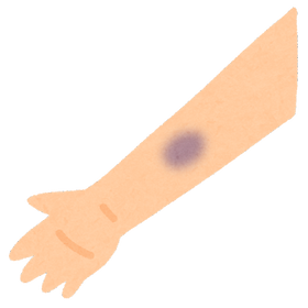 body_kega_aoaza_naisyukketsu