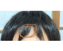 セルフカット試した結果wwwwww 鳥速 セルフカット試した結果wwwwww 鳥速