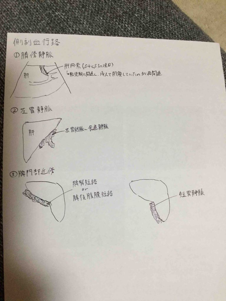 側副血行路 よくある側副血行路をノートにまとめてみました 1記事3分 超音波検査士けんしんのエコーノート