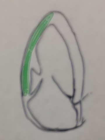 20240704_134259
