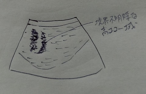 20210129_190545