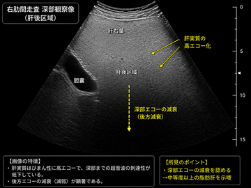 file_000000004eb4820b98a804237103c28d