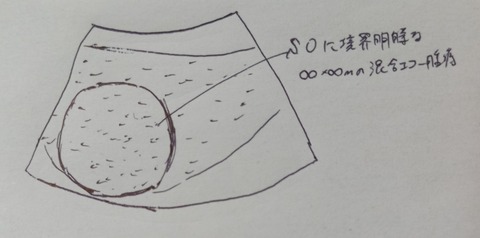 20201125_183336