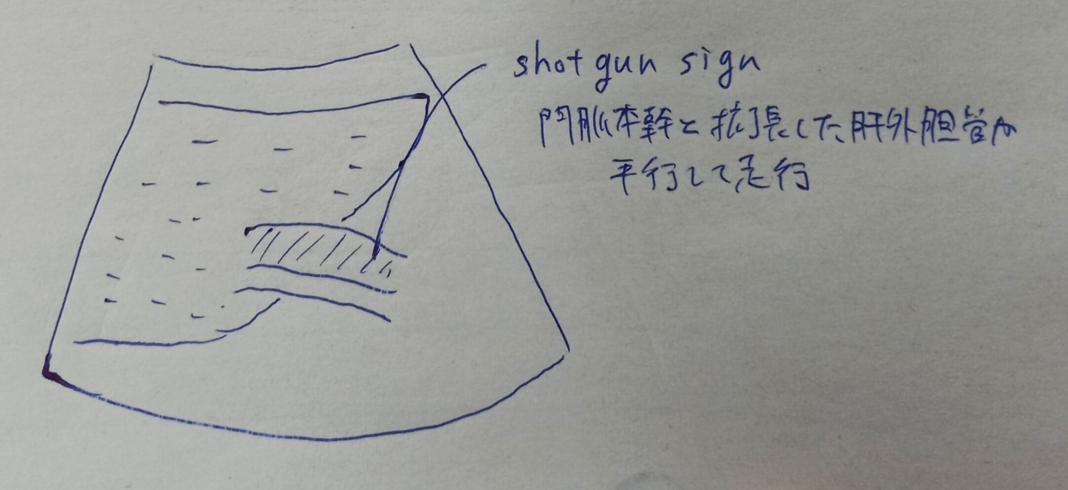 閉塞性黄疸 症例レポートの書き方のポイント 1記事3分 超音波検査士けんしんのエコーノート