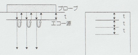 アーチファクト③