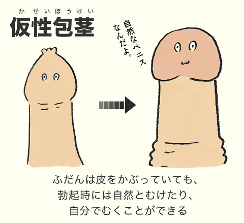男性 誰も知らない 仮性包茎 の歴史 男が劣等感を抱くようになったワケ ぼっちゃんのブログ