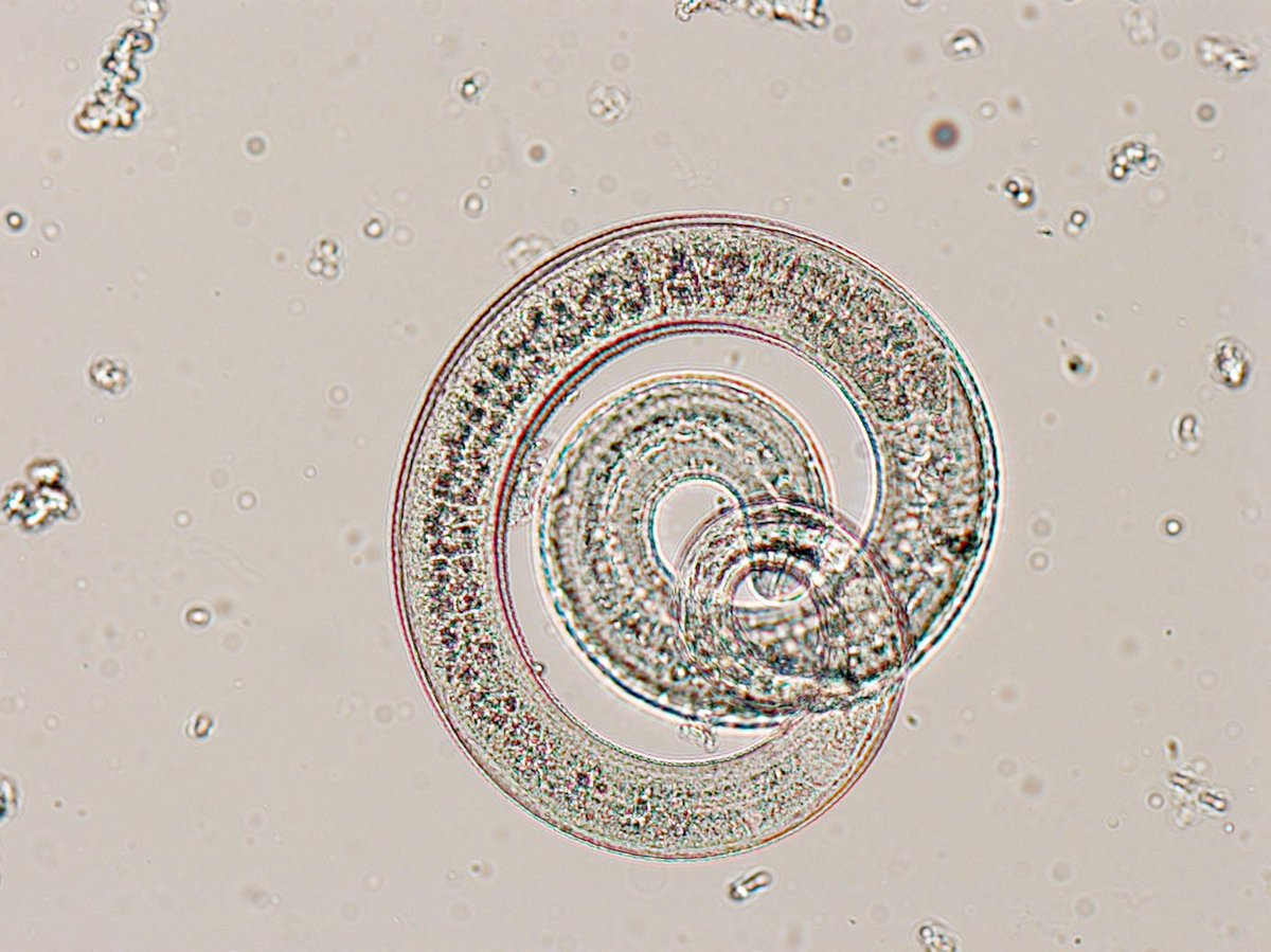 Личинки трихинеллы. Трихинелла спиральная - Trichinella spiralis. Трихинелла микрофилярии. Трихинелла микроскопия. Личинка трихинеллы микроскоп.